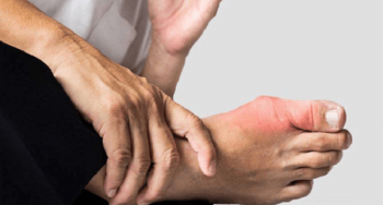 Triệu chứng đau ngón chân, nguyên nhân và cách chữa trị